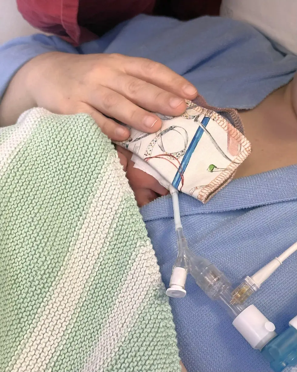 Preterm infant receiving skin-to-skin care with medical support