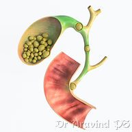 jaundice20210502_165135.png