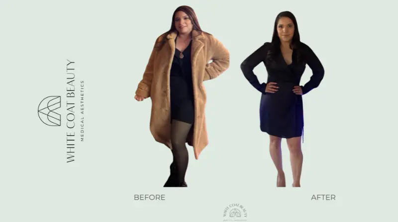 benefits of supervised weight loss programs