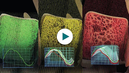 Echolight REMS technology overview video