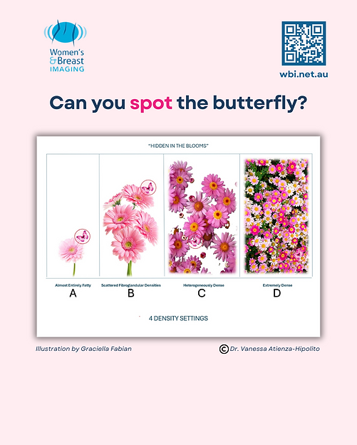 Butterfly Diagram.png
