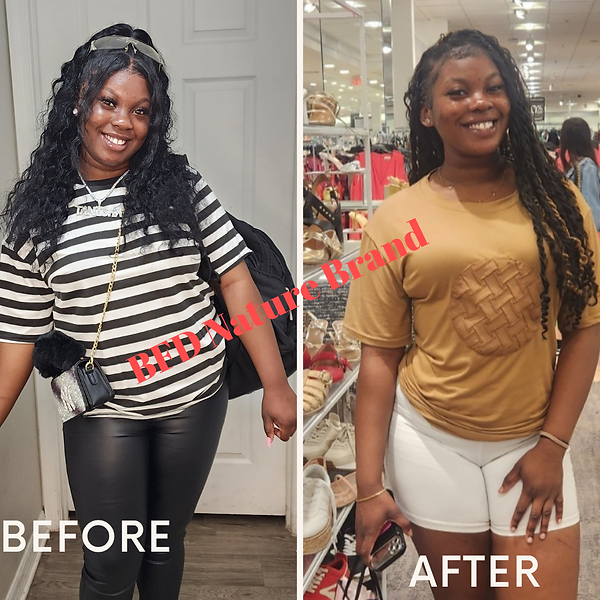 Before after minimal skincare Instagram post_20250606_222037_0000.png