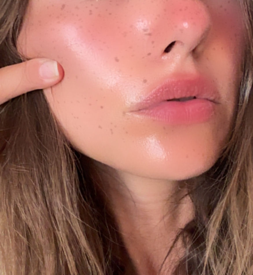 Close-up of a woman’s freckled face with a finger pointing to her cheek, glossy skin, pink lips, and brown hair.