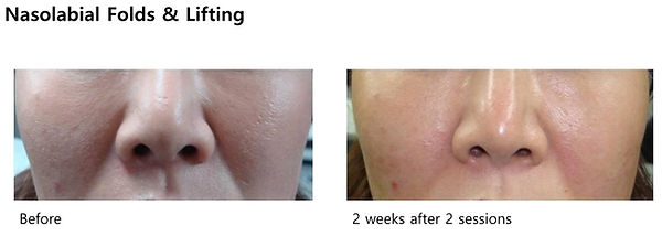 vivace Page 29 Snapshot 01.jpg