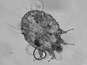 Sarcoptes scabiei mite (Supplied: Arthur Goldstein, CC BY-SA 4.0)