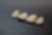 crowns and bridges infinity dental spa.jpg