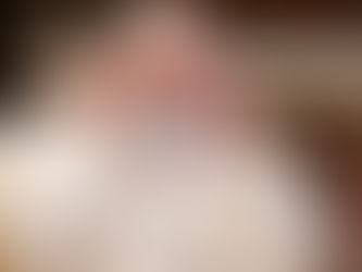 Hoy operarán al Papa Francisco de divertículos