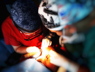 What is Follicular Unit Extraction (FUE)? And Why is it Right for You?
