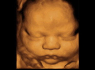 3d-ultrasound-32-weeks-1.jpg