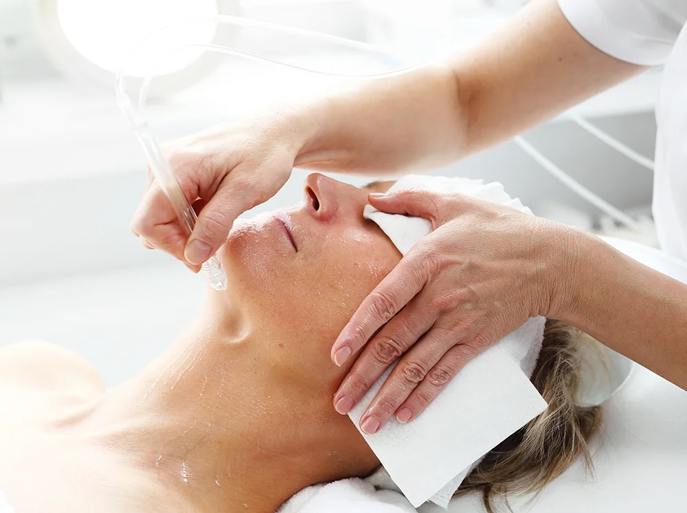 JetPeel_Künzelsau_Behandlung.webp