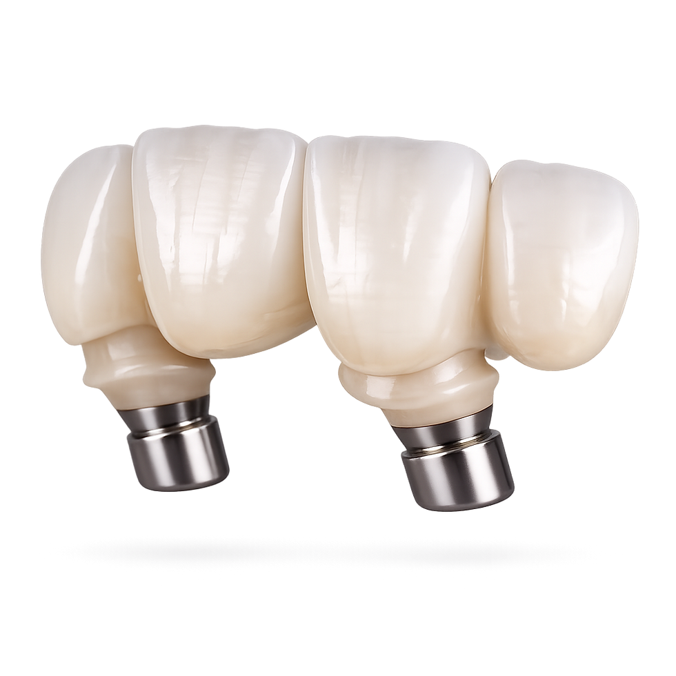 Zirconia Implant Crowns.png