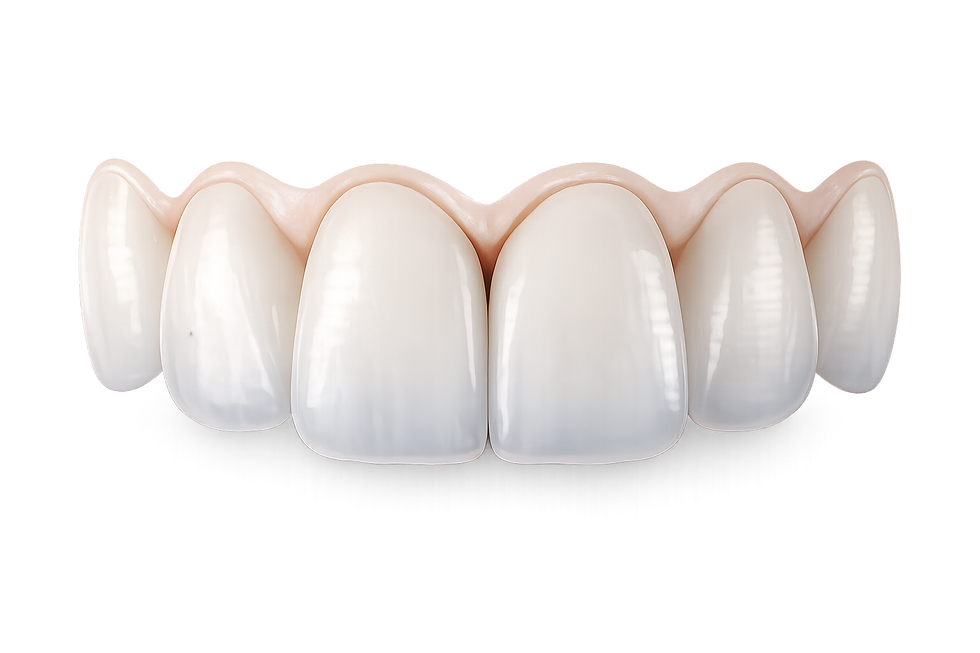 e.max Crowns.png