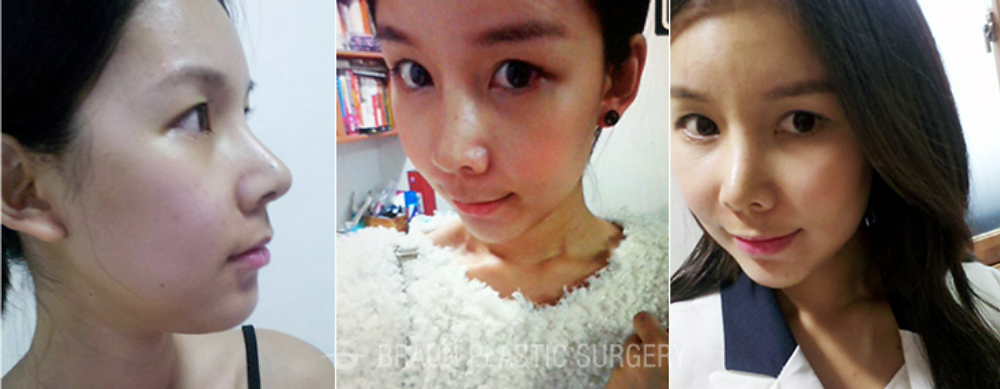 ศัลยกรรมโครงหน้าและปลูกถ่ายไขมัน