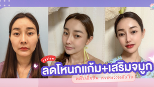 รีวิว: ศัลยกรรมลดโหนกแก้มและเสริมจมูก โรงพยาบาลศัลยกรรมจิวเวลรี่ (Jewelry Plastic Surgery)