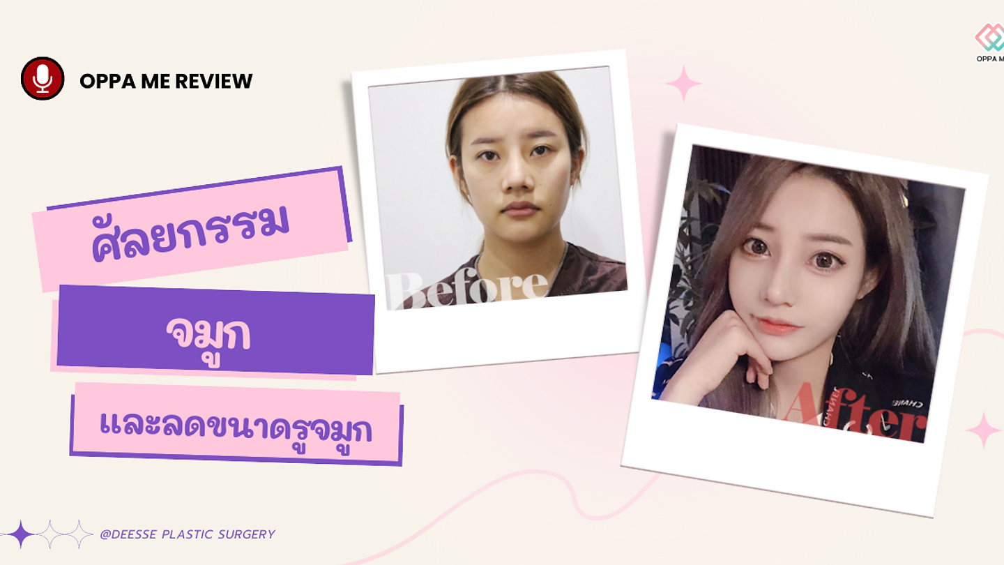 รีวิว: ศัลยกรรมจมูกและลดขนาดรูจมูก ที่โรงพยาบาลศัลยกรรมดีเซ่ @DEESSE PLASTIC SURGERY
