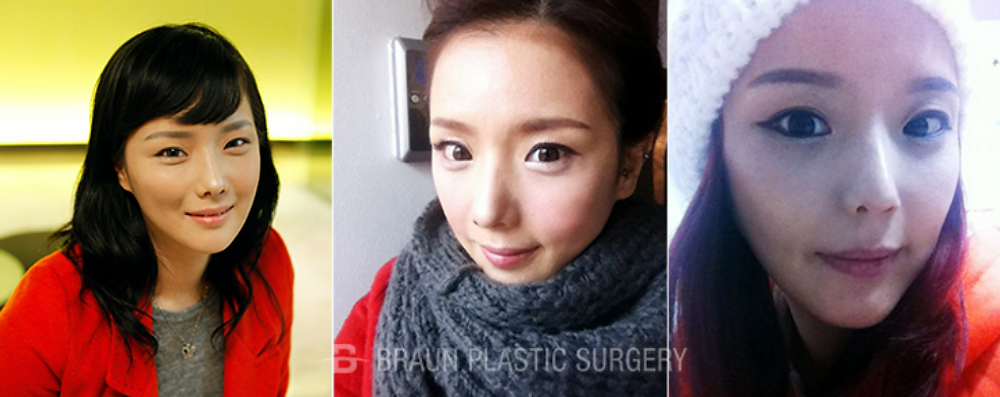 ศัลยกรรมตา จมูก โครงหน้า และปลูกถ่ายไขมัน