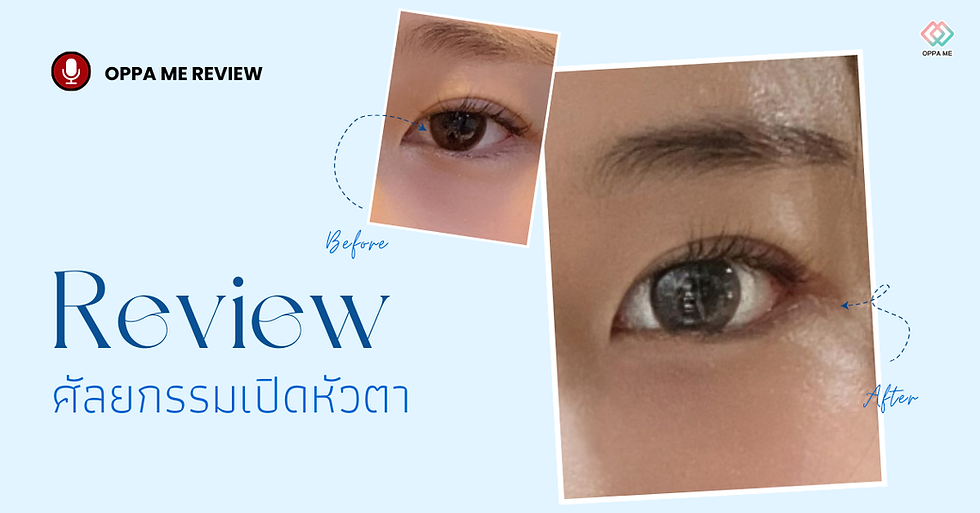 ศัลยกรรมเปิดหัวตา