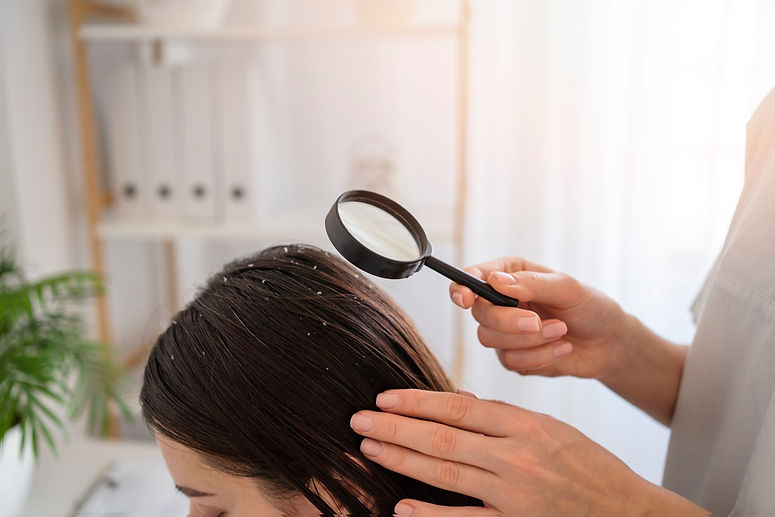 anti dandruff
