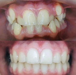 resultado ortodôntia.jpeg