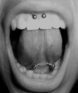 11075192_421898447978749_7952602386020325222_n