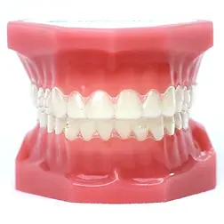 model_invisalign.jpg.webp