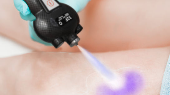 cosmetologist-performing-ultrasonic-cavitation-pro-2025-03-09-10-37-29-utc.jpg