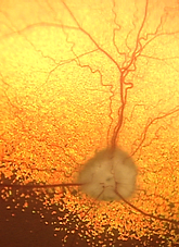 Image of the retina from a dog affected by Sudden Acquired Retinal Degeneration Syndrome - SARDS.
