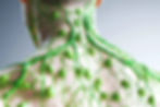 image-depicts-detailed-representation-lymphatic-system-showcasing-lymph-nodes-vessels-intr