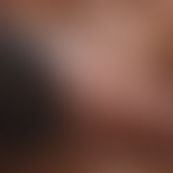 Le nouveau coronavirus et l'avenir du B.C.G.