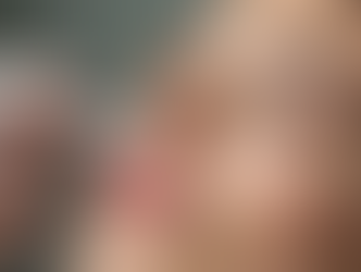 Achieve Radiant Skin with Dermaplaning: Exfoliate, Reduce Peach Fuzz, and Enhance Product Absorption