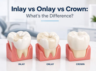 Inlay vs Onlay vs Crown