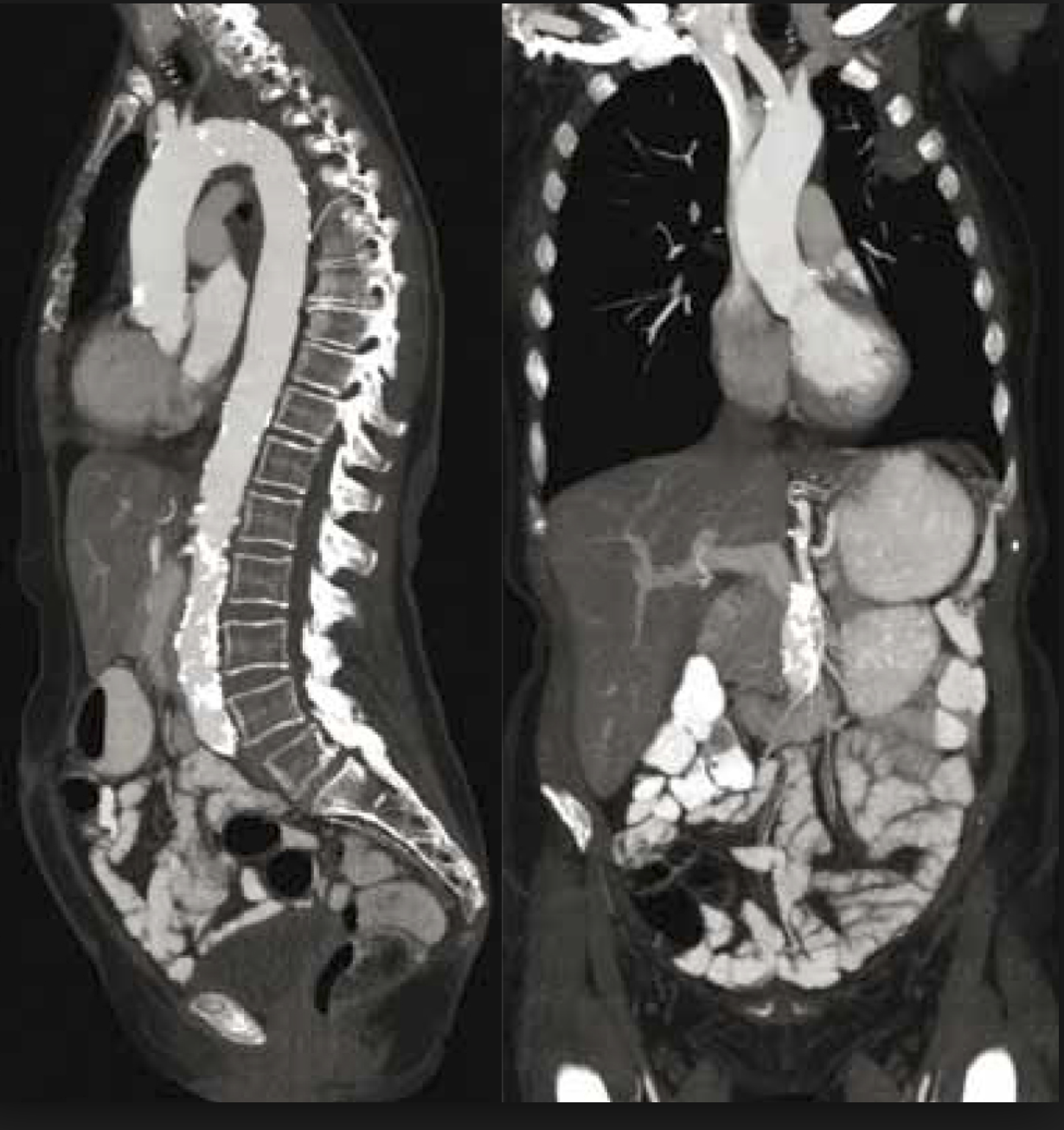 The Radiology Group CT Scan