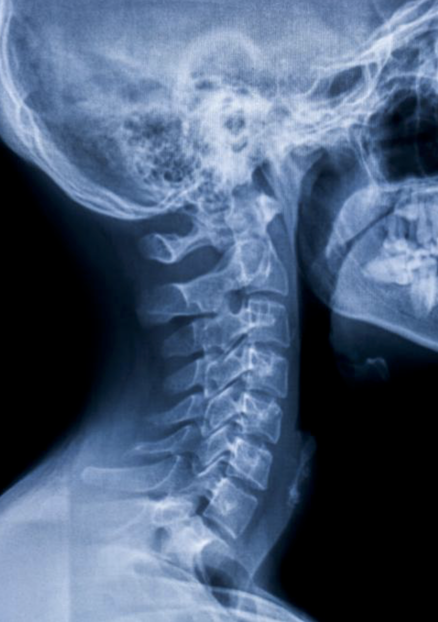 The Radiology Group X Ray the-radiology-group-x-ray