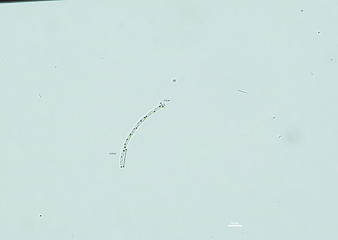 Qld QC Aug 2018 JC0176 Raphidiopsis.tif
