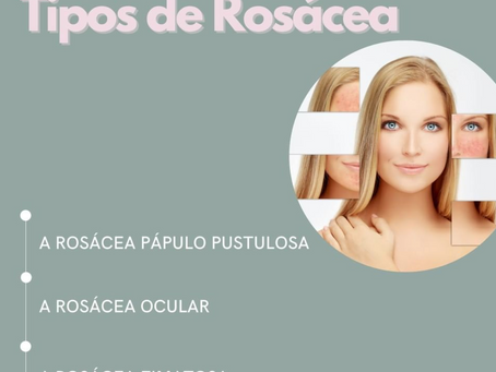 Tipos de Rosácea