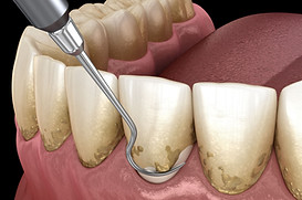perio institute courses.jpg