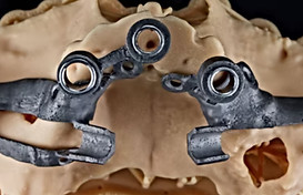 zygomatic implant course.jpg