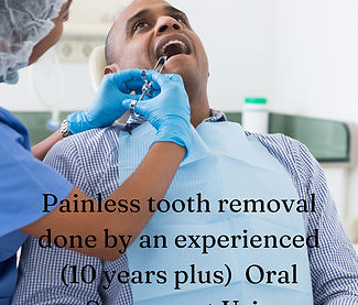 dental extraction cost.jpg
