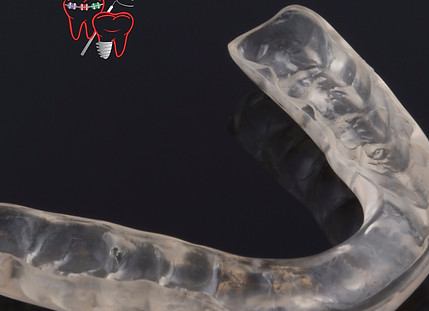 implant dental clinic near me.jpg