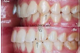 online occlusion courses.jpg