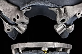 pterygoid implant course.jpg