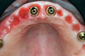 zygomatic course.jpg