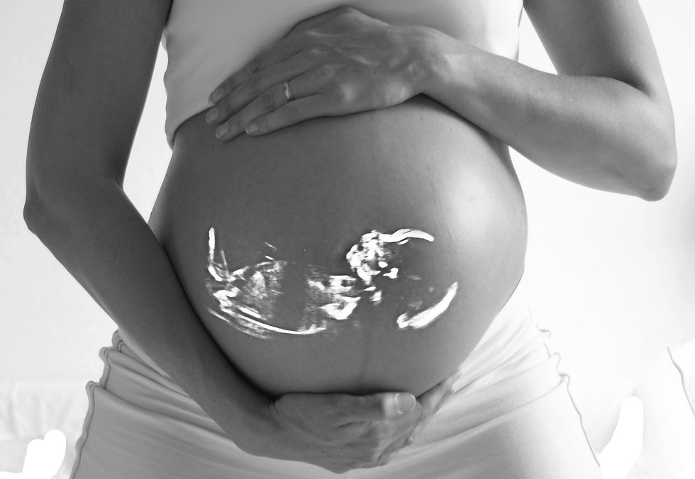 Pregnancy After 40: My Unexpected Blessing, Endometriosis Journey & Motherhood Season