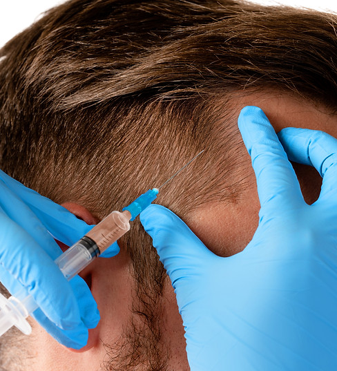 Closeup of doctor's hand with a syringe and man receiving scalp injection for hair grow.jp