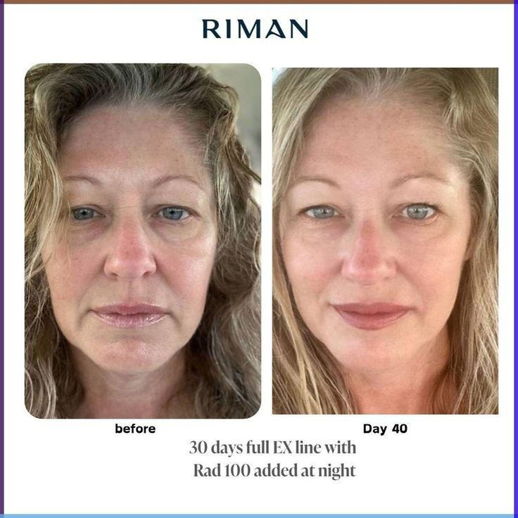 Thumbnail: INCELLDERM  Skincare Full Set (10 items)