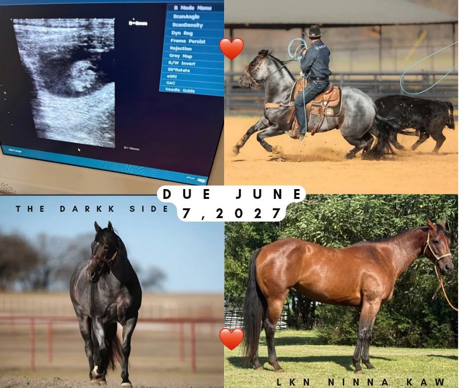 Ultrasound