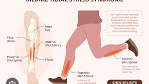 Shin Splints Be Gone: What can we do about this nagging injury that happens every pre-season?