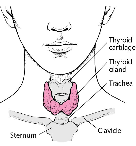 hypothyroidism