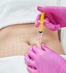 lemon bottle needle size for fat dissolving Lemon Bottle Fat Dissolving Injections: Are They Safe? main image 0