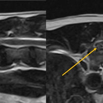 What is IVDD? - IVDD Explained Simply